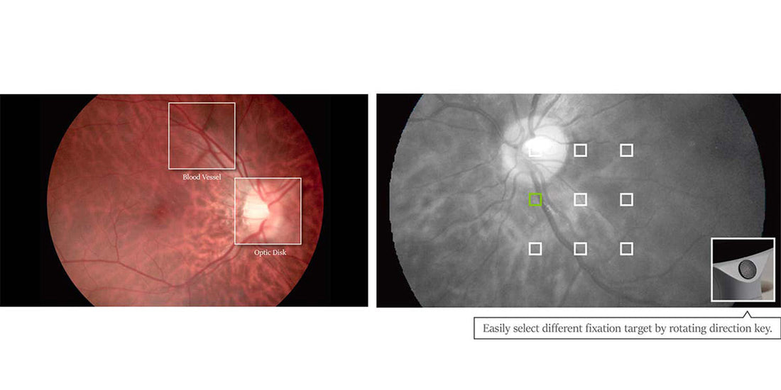 INS-11105 | Hand-held Fundus Camera